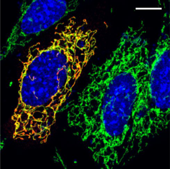 Welche Rolle spielen Mitochondrien bei Blutgerinnseln?