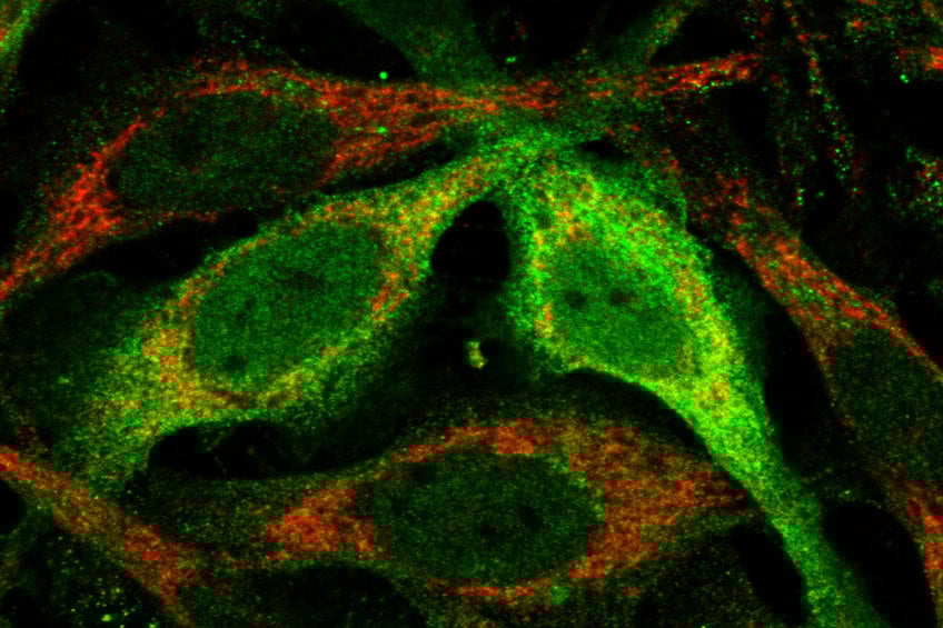 Welche Rolle spielen Mitochondrien bei Hautkrankheiten?